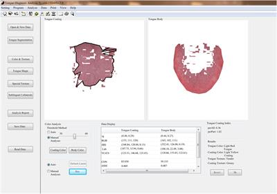 A lung cancer risk warning model based on tongue images